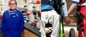 científica de Honduras cura distrofia muscular sintomas